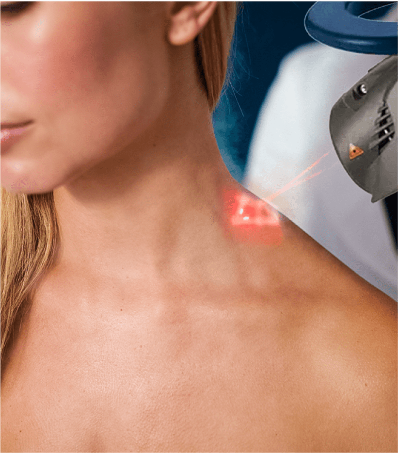 Laser Therapy on shoulder